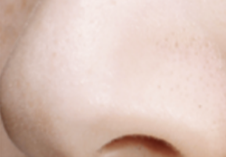 角栓・毛穴汚れが少ない肌